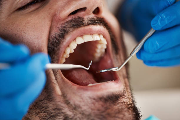 Best Cosmetic Emergency Dentistry in Holtville, CA