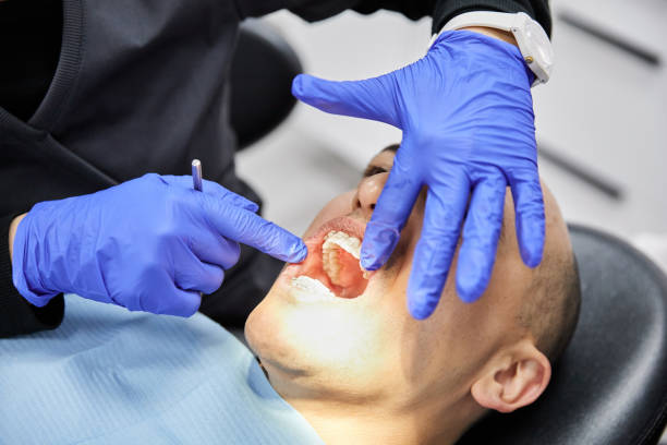 Best Emergency Dental Care for Broken or Chipped Teeth in Holtville, CA